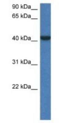 Western Blot: FGGY carbohydrate kinase domain containing Antibody [NBP1-79275]