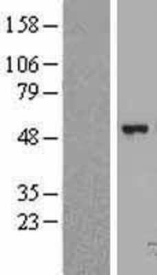 Western Blot: FGGY carbohydrate kinase domain containing Overexpression Lysate [NBL1-10709]