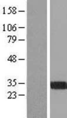 Western Blot: Hepassocin/FGL1 Overexpression Lysate [NBL1-10710]