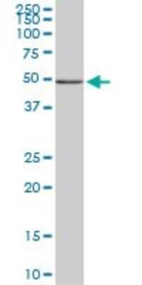 Western Blot: FGL2/Fibroleukin Antibody (5A10) [H00010875-M02]