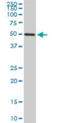 Western Blot: FGL2/Fibroleukin Antibody (5A10) [H00010875-M02]