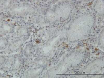 Immunohistochemistry-Paraffin: FGL2/Fibroleukin Antibody (6D9) [H00010875-M01]