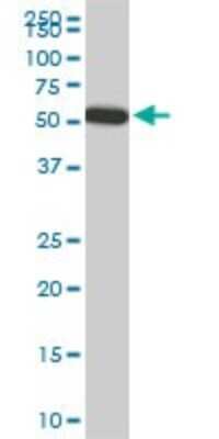 Western Blot: FGL2/Fibroleukin Antibody (6D9) [H00010875-M01]