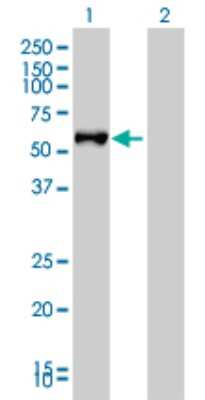 Western Blot: FGL2/Fibroleukin Antibody (6D9) [H00010875-M01]