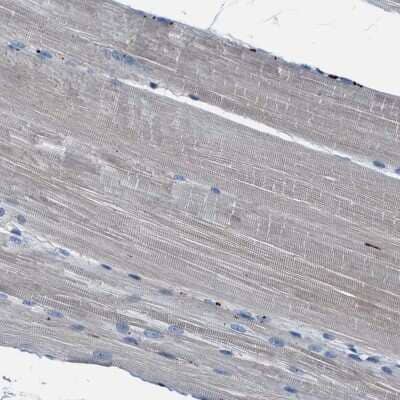 Immunohistochemistry-Paraffin: FGL2/Fibroleukin Antibody [NBP1-87198]