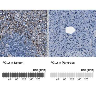 Immunohistochemistry-Paraffin: FGL2/Fibroleukin Antibody [NBP1-87198]