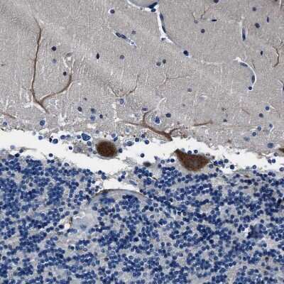 Immunohistochemistry-Paraffin: FGL2/Fibroleukin Antibody [NBP1-87198]
