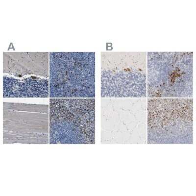 Immunohistochemistry-Paraffin: FGL2/Fibroleukin Antibody [NBP1-87198]