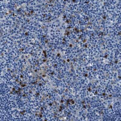 Immunohistochemistry-Paraffin: FGL2/Fibroleukin Antibody [NBP1-87198]