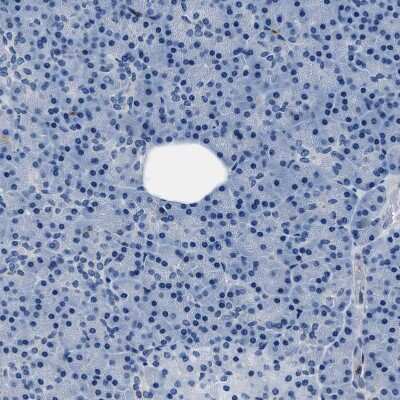 Immunohistochemistry-Paraffin: FGL2/Fibroleukin Antibody [NBP1-87198]