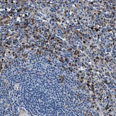 Immunohistochemistry-Paraffin: FGL2/Fibroleukin Antibody [NBP1-87198]