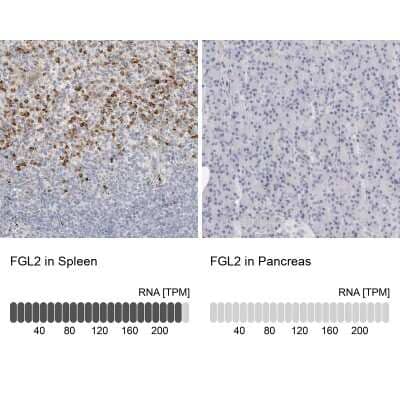Immunohistochemistry-Paraffin: FGL2/Fibroleukin Antibody [NBP1-87199]