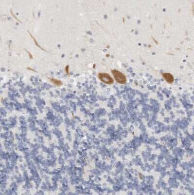 Immunohistochemistry-Paraffin: FGL2/Fibroleukin Antibody [NBP1-87199]