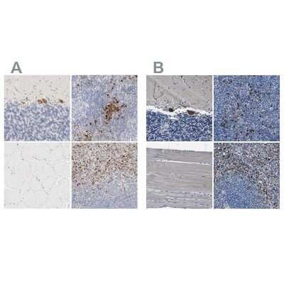 Immunohistochemistry-Paraffin: FGL2/Fibroleukin Antibody [NBP1-87199]