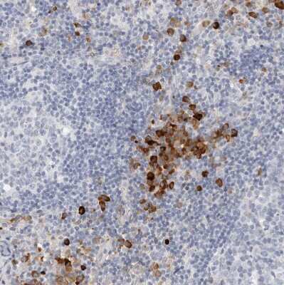 Immunohistochemistry-Paraffin: FGL2/Fibroleukin Antibody [NBP1-87199]