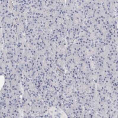 Immunohistochemistry-Paraffin: FGL2/Fibroleukin Antibody [NBP1-87199]