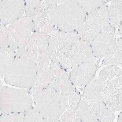 Immunohistochemistry-Paraffin: FGL2/Fibroleukin Antibody [NBP1-87199]