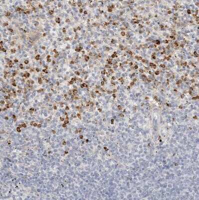 Immunohistochemistry-Paraffin: FGL2/Fibroleukin Antibody [NBP1-87199]