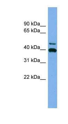 Western Blot: FGL2/Fibroleukin Antibody [NBP1-56965]