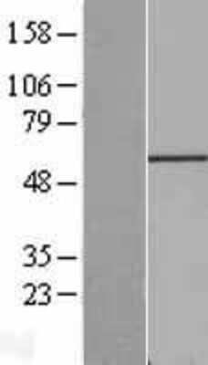 Western Blot: Fgr Overexpression Lysate [NBL1-10712]