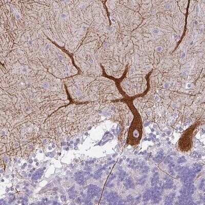 Immunohistochemistry-Paraffin: FHAD1 Antibody [NBP2-14780]