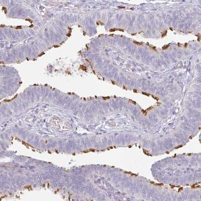 Immunohistochemistry-Paraffin: FHAD1 Antibody [NBP2-14780]