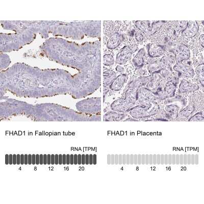 Immunohistochemistry-Paraffin: FHAD1 Antibody [NBP2-14780]