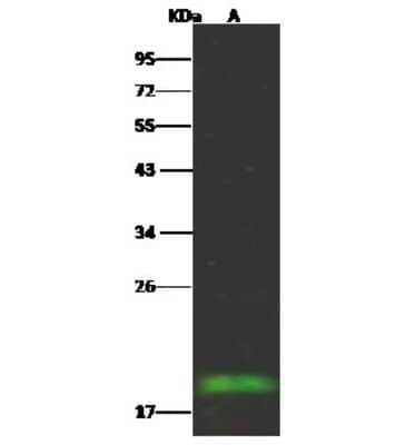 Western Blot: FHIT Antibody (104) [NBP2-90283]