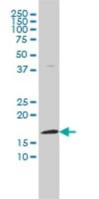 Western Blot: FHIT Antibody (1E3) [H00002272-M03]