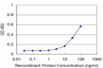 ELISA: FHIT Antibody (1H2) [H00002272-M07]