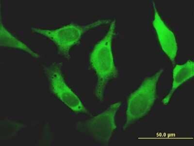 Immunocytochemistry/ Immunofluorescence: FHIT Antibody (1H2) [H00002272-M07]