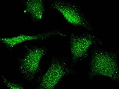 Immunocytochemistry/ Immunofluorescence: FHIT Antibody [NBP3-00295]