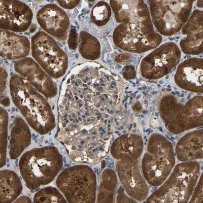 Immunohistochemistry-Paraffin: FHIT Antibody [NBP1-89061]
