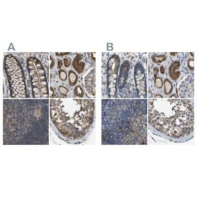 Immunohistochemistry-Paraffin: FHIT Antibody [NBP1-89061]