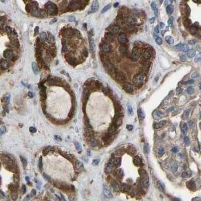 Immunohistochemistry-Paraffin: FHIT Antibody [NBP1-89061]