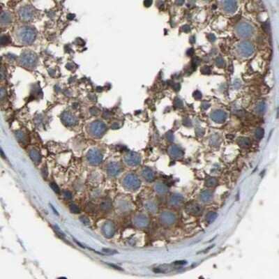 Immunohistochemistry-Paraffin: FHIT Antibody [NBP1-89061]