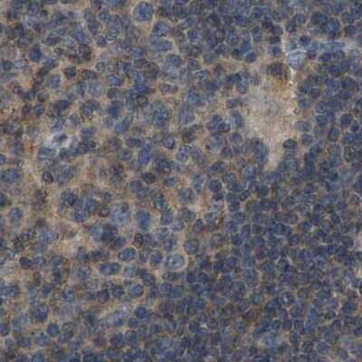 Immunohistochemistry-Paraffin: FHIT Antibody [NBP1-89061]