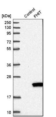 Western Blot: FHIT Antibody [NBP1-89062]