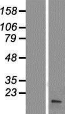 Western Blot: FHIT Overexpression Lysate [NBP2-08155]