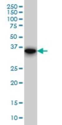 Western Blot: FHL1 Antibody (2A9) [H00002273-M01]
