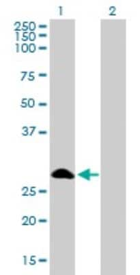 Western Blot: FHL1 Antibody (2A9) [H00002273-M01]