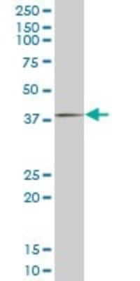 Western Blot: FHL1 Antibody (2F7) [H00002273-M05]