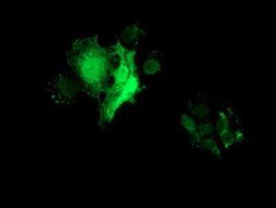 Immunocytochemistry/ Immunofluorescence: FHL1 Antibody (OTI3G7) [NBP2-02654]