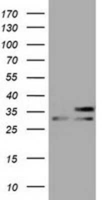Western Blot: FHL1 Antibody (OTI3G7) [NBP2-02654]