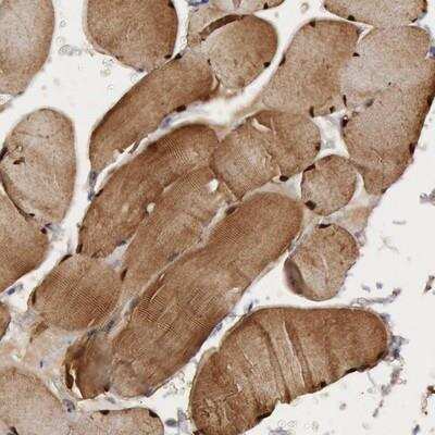 Immunohistochemistry: FHL1 Antibody [NBP1-88746]