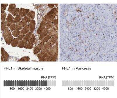 Immunohistochemistry-Paraffin: FHL1 Antibody [NBP1-88745]