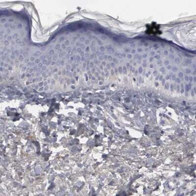 Immunohistochemistry-Paraffin: FHL1 Antibody [NBP1-88746]