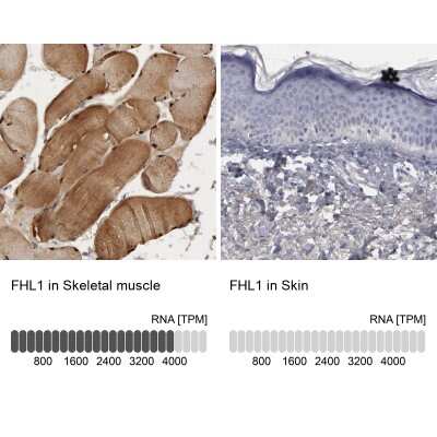 Immunohistochemistry-Paraffin: FHL1 Antibody [NBP1-88746]