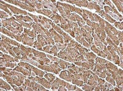 Immunohistochemistry-Paraffin: FHL1 Antibody [NBP2-16490]