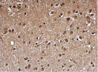 Immunohistochemistry-Paraffin: FHL1 Antibody [NBP2-16490]